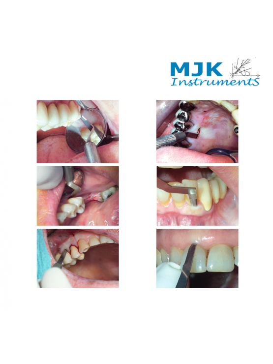 Bisturis descartáveis MJK - Pack 5